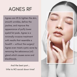 AGNES Precision RF Technology